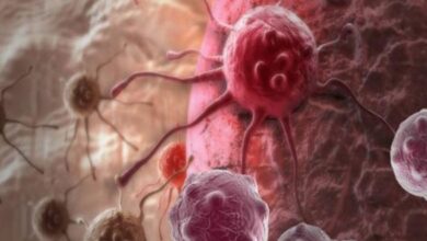 بشرى: تقنية طبية جديدة تمنح الأمل لمرضى السرطان.. - المصدر تونس