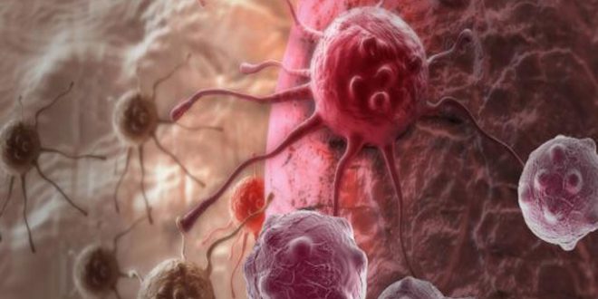 بشرى: تقنية طبية جديدة تمنح الأمل لمرضى السرطان.. - المصدر تونس